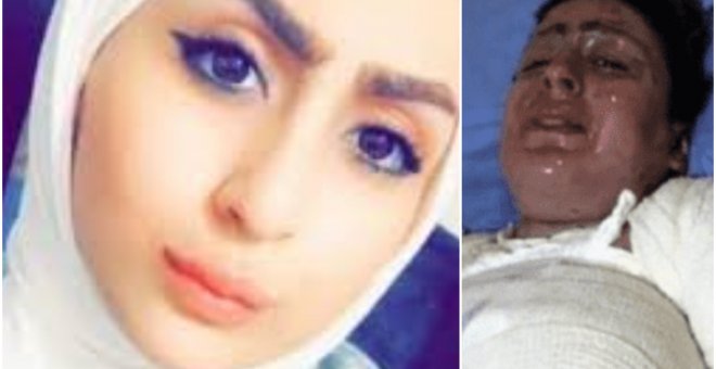 Muere la mujer iraquí que se quemó ante los reiterados malos tratos de su marido