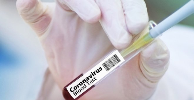 1 de cada 3 infectados de coronavirus es asintomático según el estudio de seroprevalencia