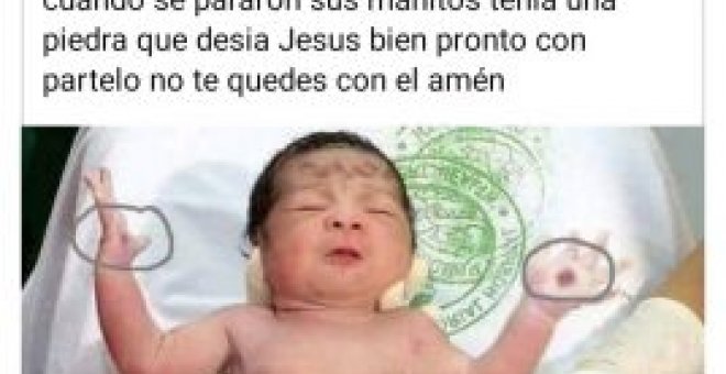 Bulocracia - El bebé con marcas divinas en las manos: la fe y el Photoshop mueven montañas