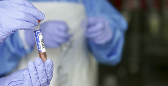 SAE pide protocolos para que las PCR a los sanitarios sean "efectivas"