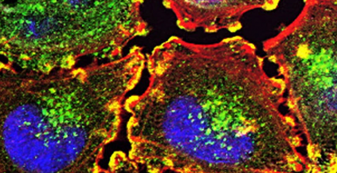 Otras miradas - La senescencia celular: el gran desafío para entender y tratar el cáncer