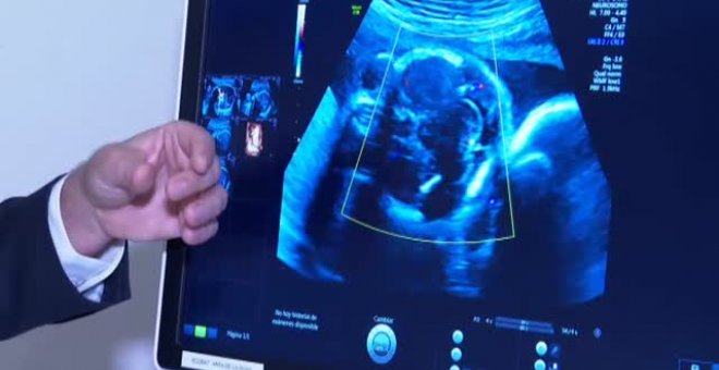 La Fundación La Caixa impulsa el primer gran proyecto europeo de placenta artificial