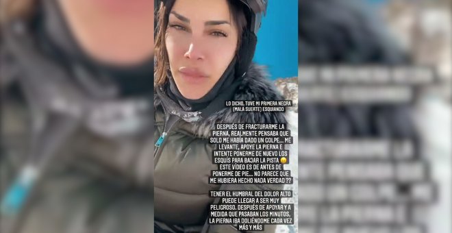 Carla Barber comparte imágenes de su operación tras fracturarse la tibia