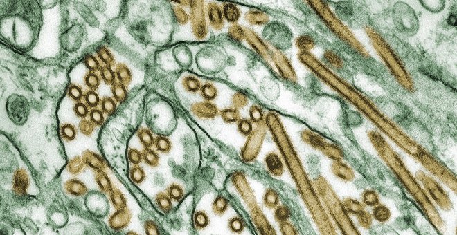 Otras miradas - ¿Cómo es posible que la gripe haya casi desaparecido pero el coronavirus siga extendiéndose?