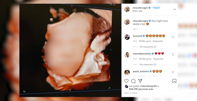 Chiara Ferragni recuerda el nacimiento de su hijo, "el mejor momento" de su vida