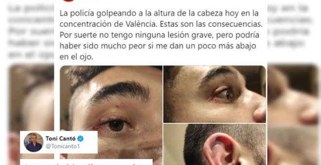 Toni Cantó se ríe de un manifestante que denuncia una agresión policial en una manifestación en apoyo a Pablo Hasél