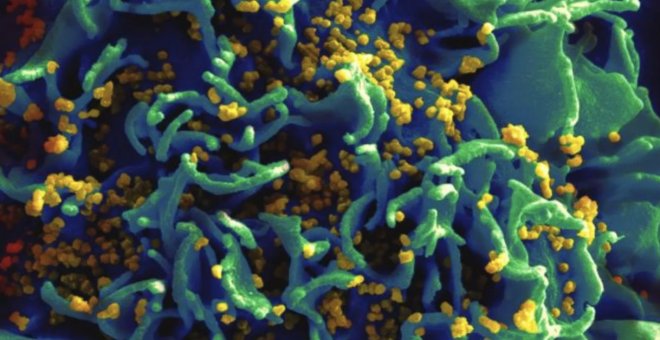 Principia Marsupia - La búsqueda de una vacuna frente al sida nos trajo las vacunas para la covid