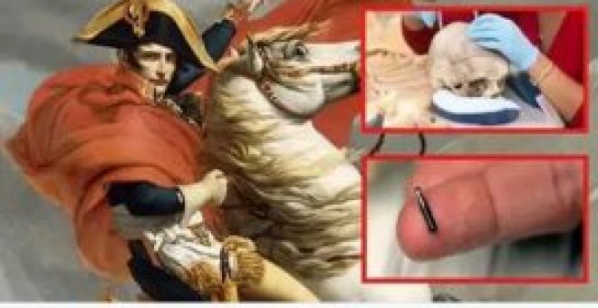 Bulocracia - La 'teoría' del chip en el cráneo de Napoleón tras ser abducido por extraterrestres