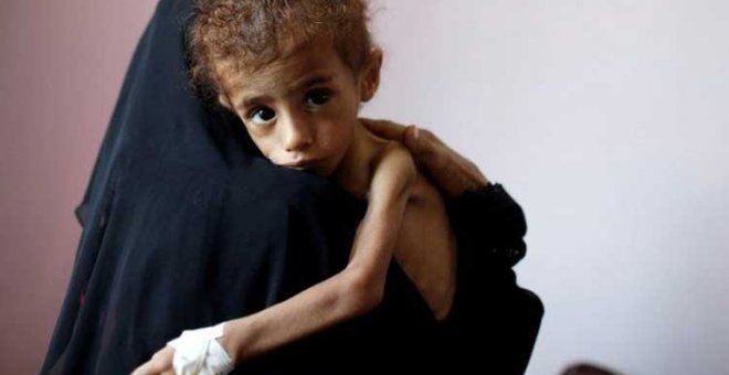 Ocho mil mujeres embarazadas y más de cien mil bebés mueren cada año en Yemen