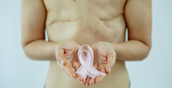 Un medicamento frena el avance de un agresivo tipo de cáncer de mama en el 76% de los casos