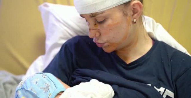 Una madre ucraniana salva la vida de su bebé de seis semanas al protegerlo con su cuerpo