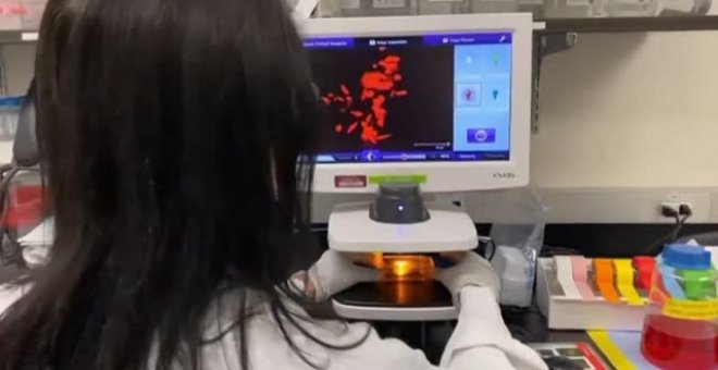 Decretada la alerta sanitaria tras detectarse 23 pacientes sospechosos de tener la viruela del mono