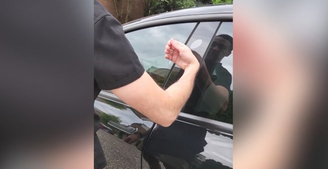El dueño de un Tesla se implanta un chip para poder abrir la puerta sin llave: "Incrustarse unas ruedas en los pies igual le pareció demasiado"