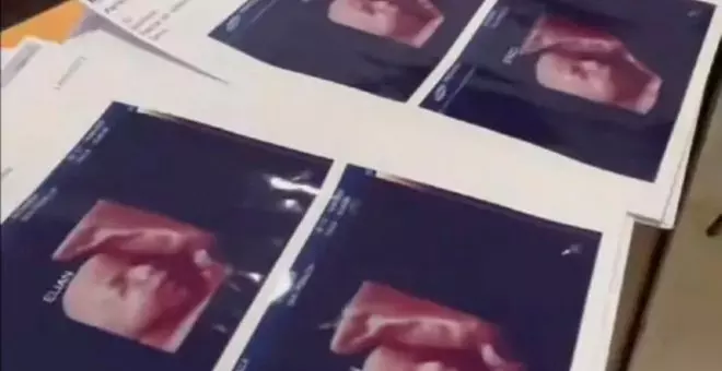 El caso de la clínica de ecografías que entregaba la misma foto a las embarazadas
