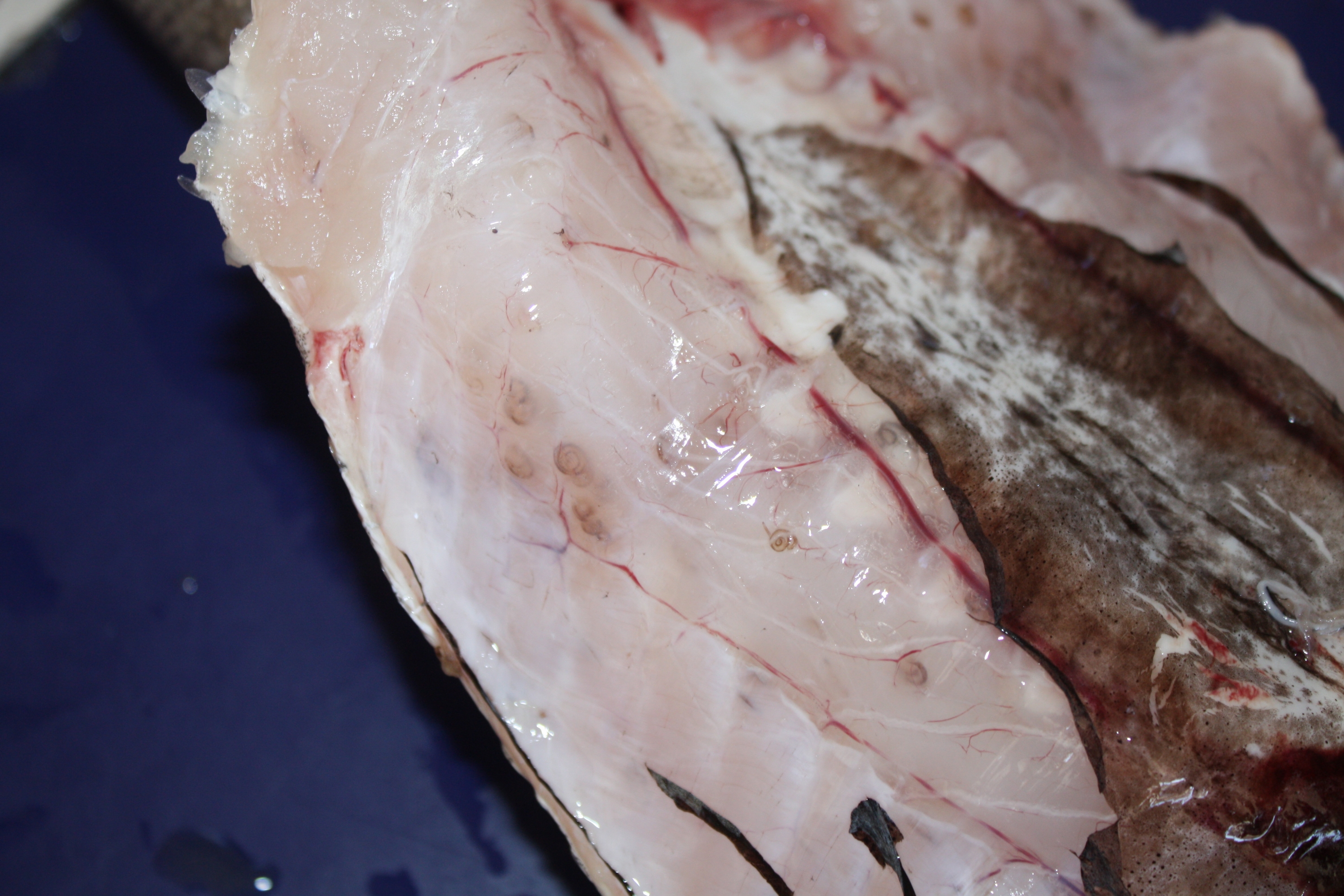 Anisakis: Primeros casos de intoxicación por anisakis en pescado congelado