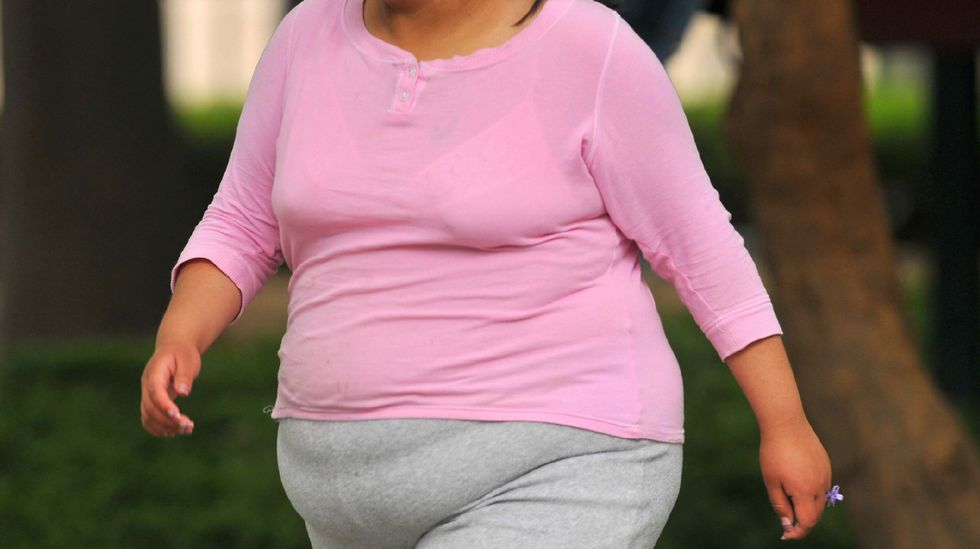Obesidad El 80 De Los Hombres Y El 55 De Las Mujeres De España 